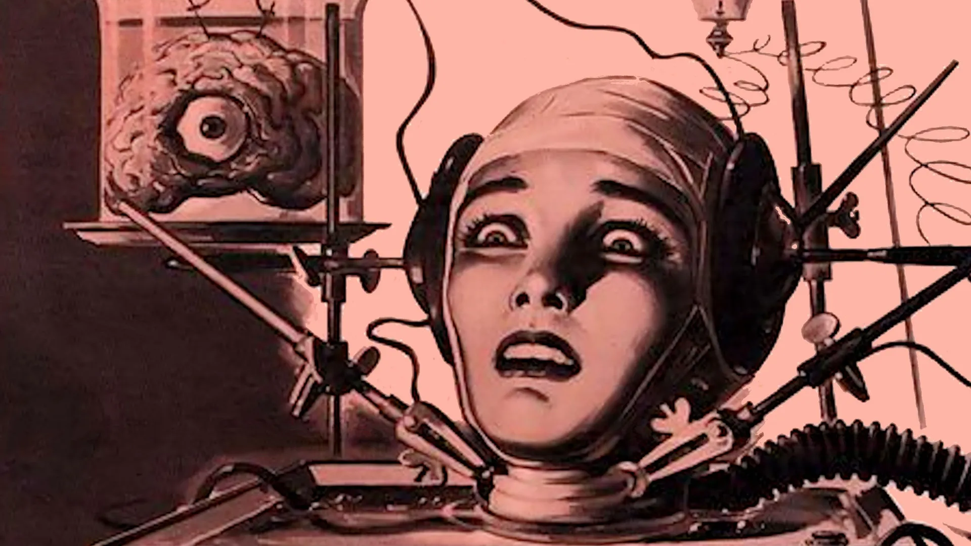 The Brain That Wouldn't Die