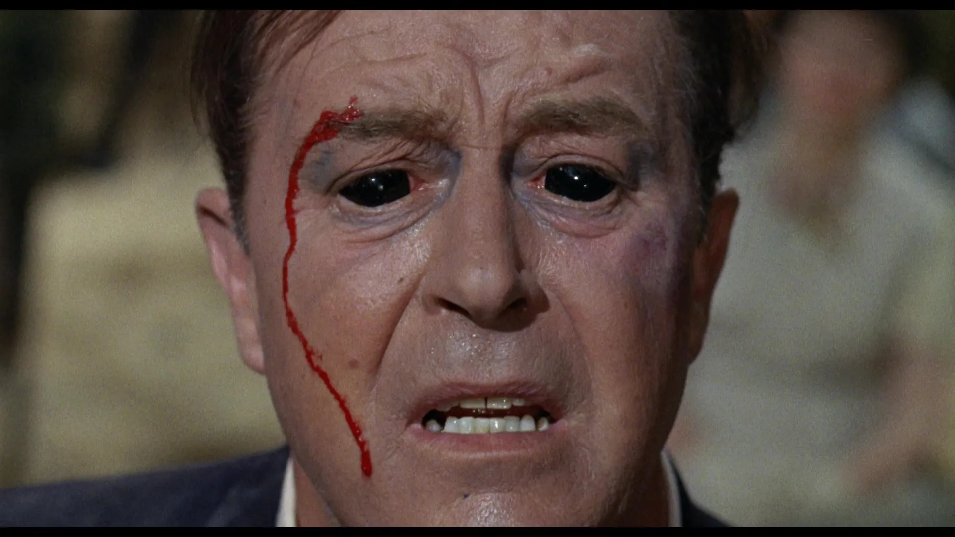 X: The Man With The X-Ray Eyes