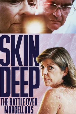 Skin Deep: The Battle Over Morgellons