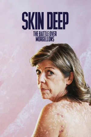 Skin Deep: The Battle Over Morgellons