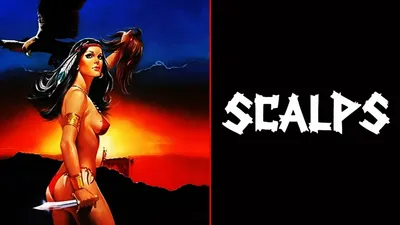 Scalps