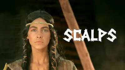 Scalps